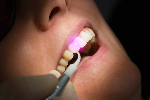 Dental lasers are versatile and used to decrease recovery times and improve patient outcomes.